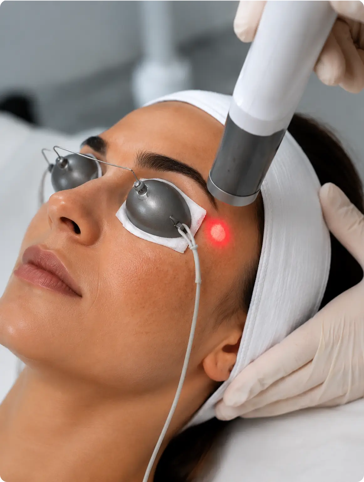 Best Pigmentation treatment in Hyderabad
