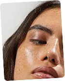 No 1 Skin Clinic in Hyderabad