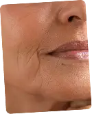 Top skin clinic in Hyderabad